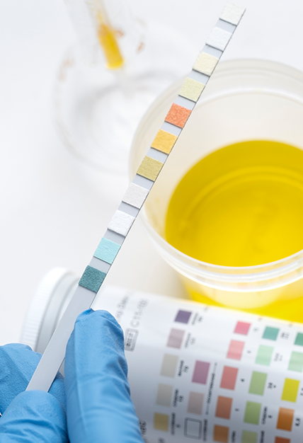 소변 유기산 검사