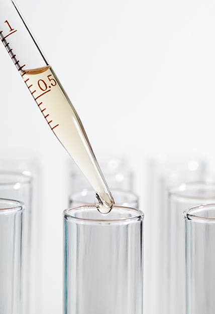 지연성 음식 알러지 검사